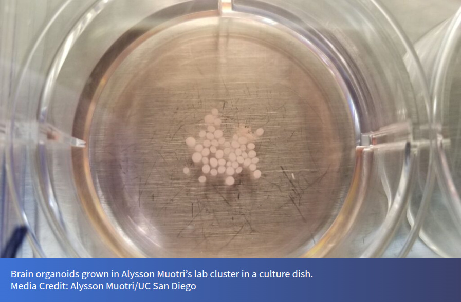 Research in Low Earth Orbit showing human brain organoids grown in a laboratory culture dish.