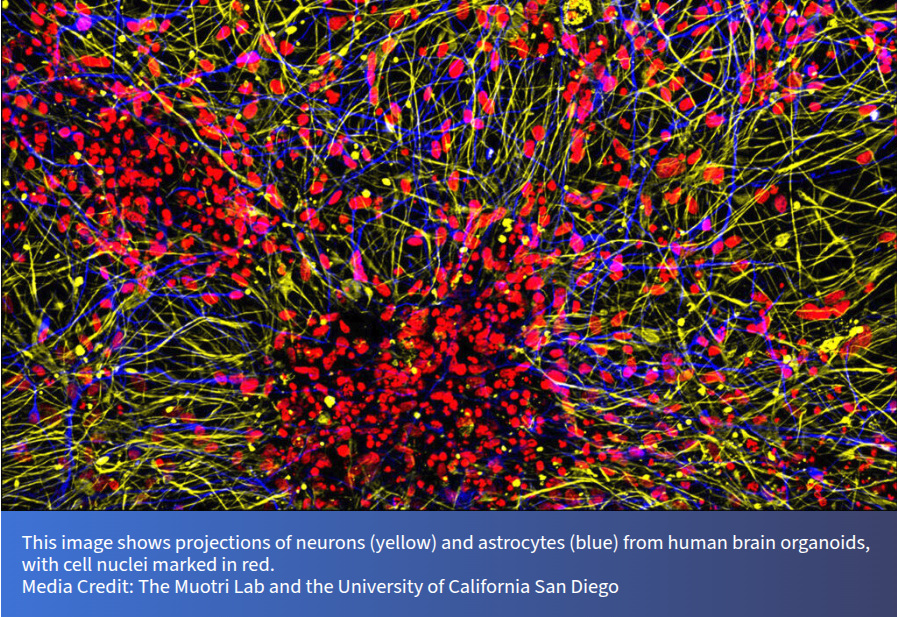 Research in Low Earth Orbit illustrating neurons in yellow, astrocytes in blue, and cell nuclei in red in human brain organoid tissue.